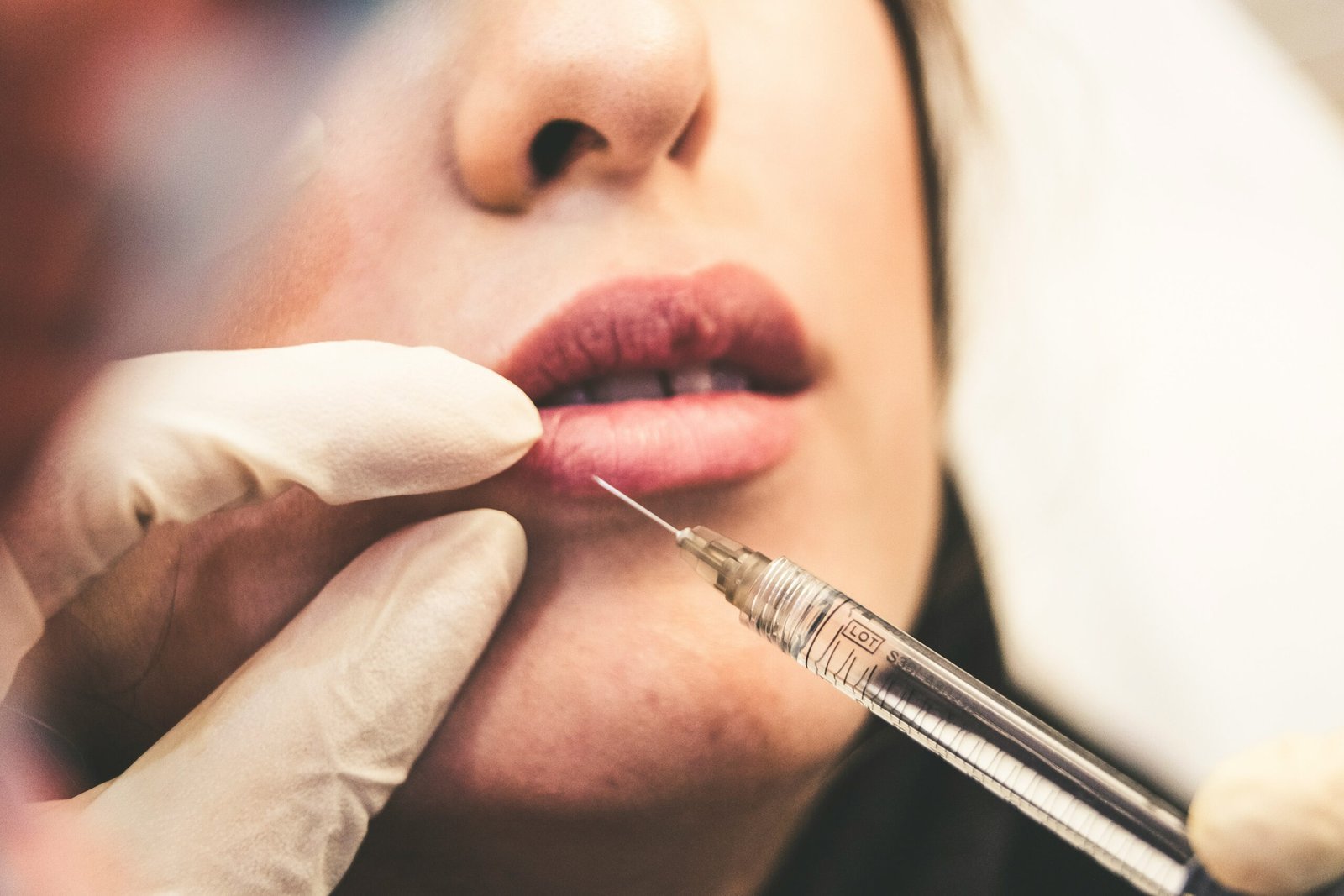 Application de Botox sur la lèvre